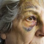 nursing-home-abuse-NC